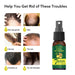 EELHOE Foreign Trade Cross-border Ginger Nutrition Spray Ginger Hair Root Spray Moisturizing Hair Hair Care Spray Spray