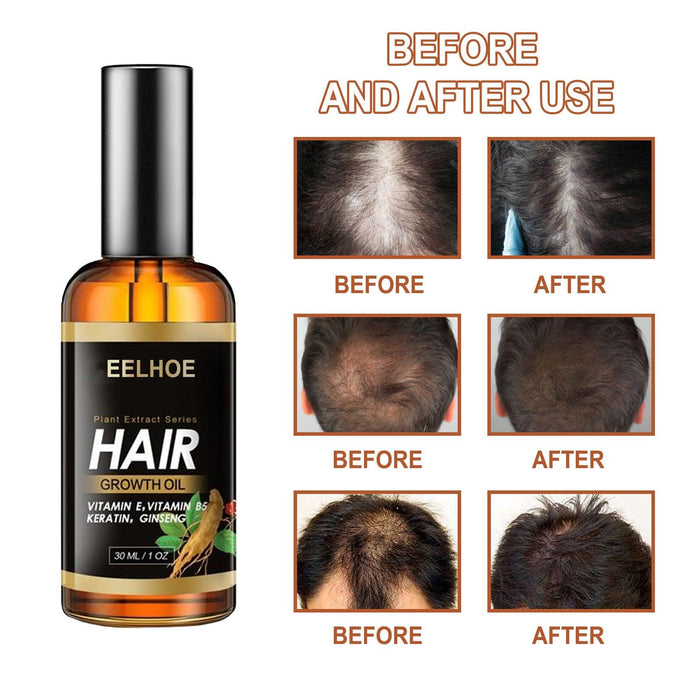 EELHOE Herb Essence Hair Hairdressing Hair Care Essential Oil Hair Strong Hair Reduce Hair Loss Broken Hair Hair Care Essential Oil