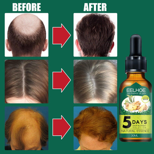 Household Ginger Hair Care Essential Oil Head